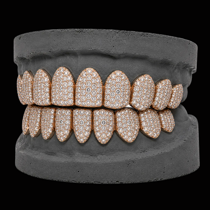 VVS Moissanite Snow Diamond Grillz
