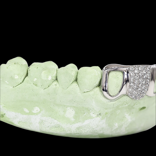VVS Moissanite 1 Tooth Diamond & 2 Teeth Open Faced Diamond Grillz