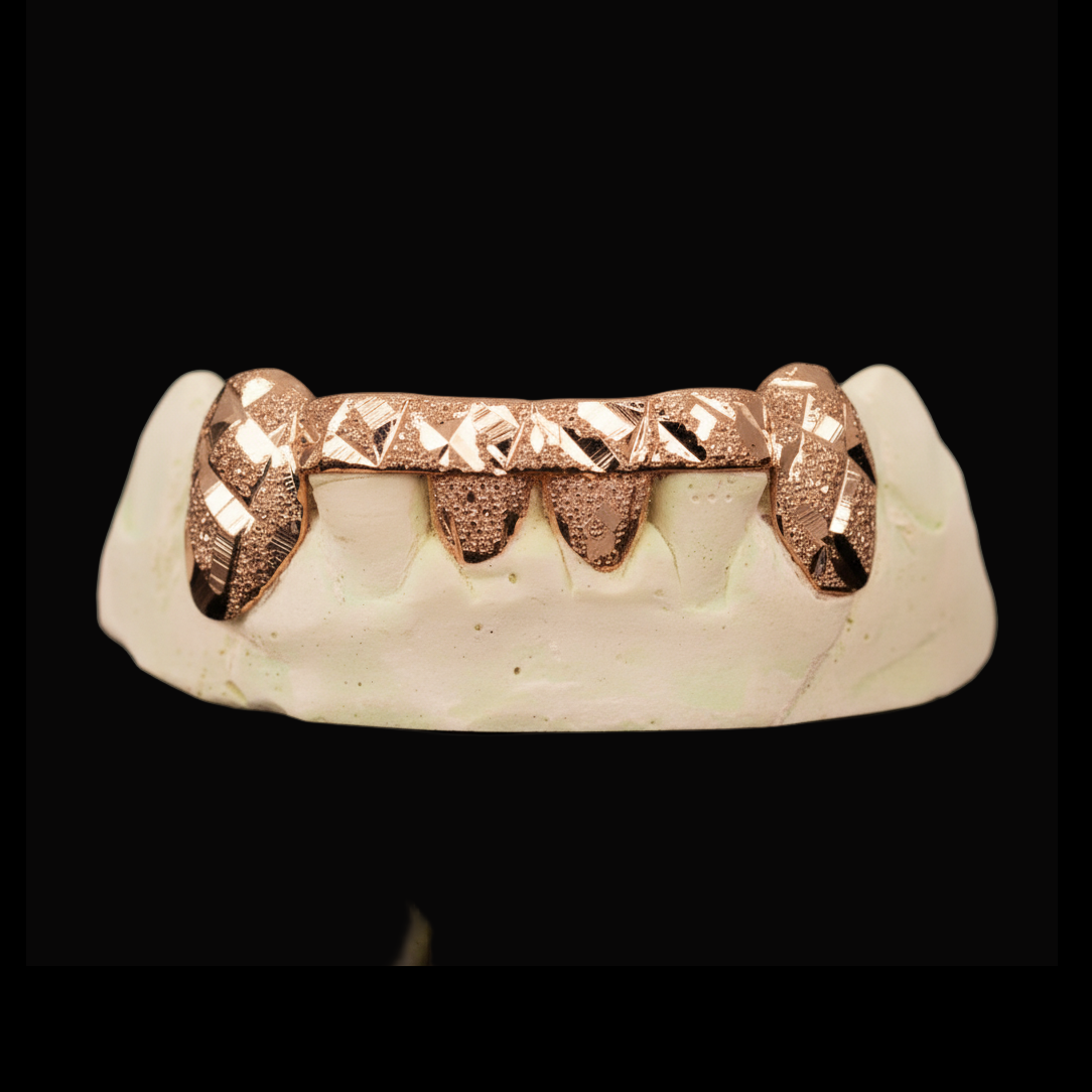 Custom 2 Teeth Diamond Cut And Diamond Dust With Front And Back Bar Gold Grillz