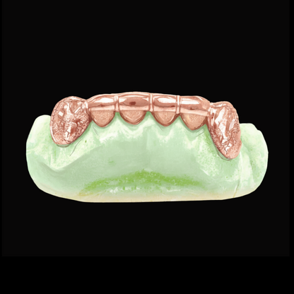 Custom 2 Teeth With Front Bar With Nugget Cut On Fangs Gold Grillz