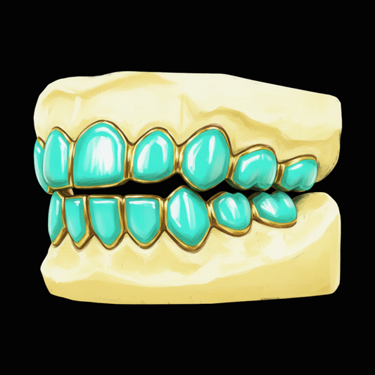 Custom 8 On 8 Mint Condition Gold Grillz