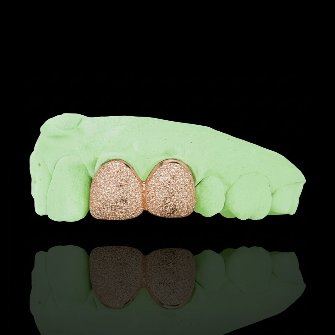 Custom Any 2 Teeth Grillz Diamond Dust (Connected) Gold Grillz