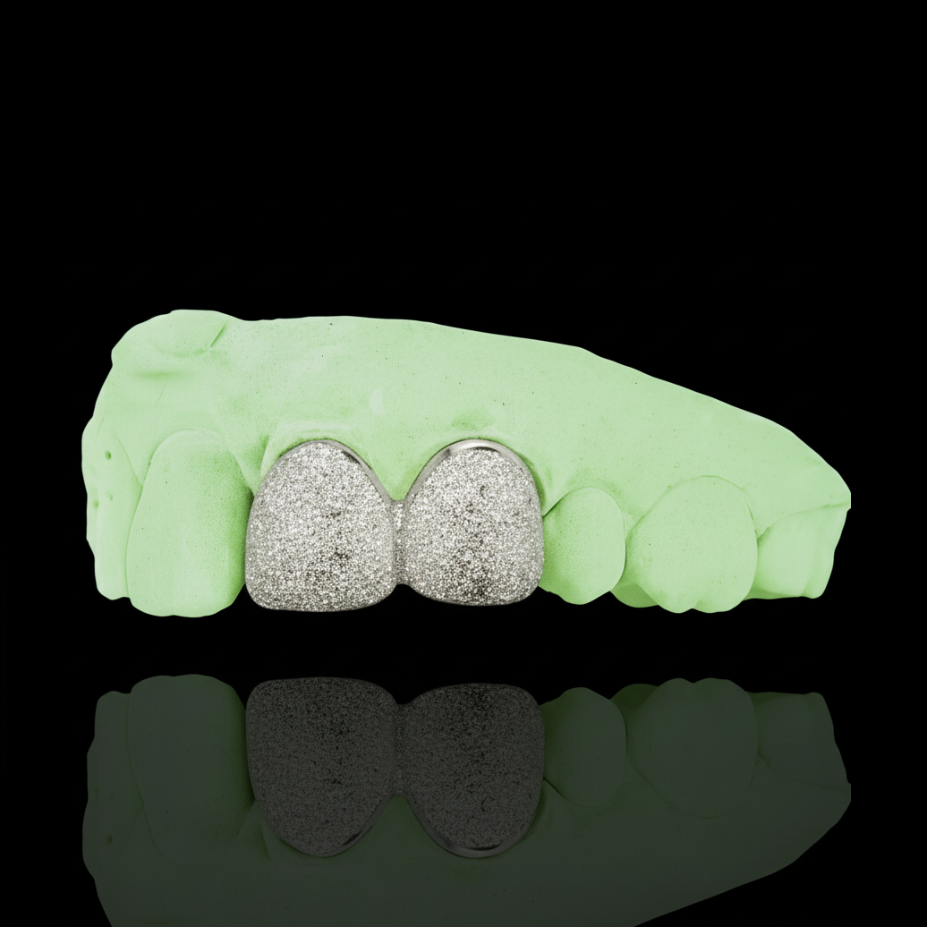 Custom Any 2 Teeth Grillz Diamond Dust (Connected) Gold Grillz