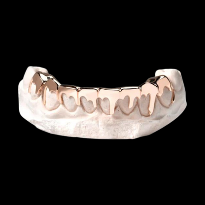 Custom Extra Sharp Drip Gold Grillz