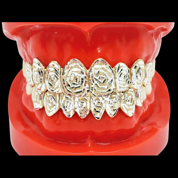 Custom gold grillz set with geometric floral cutouts on dental model