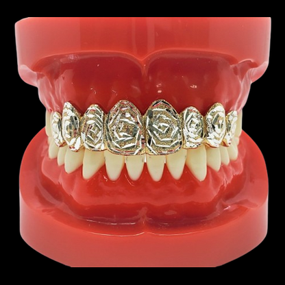Rose pattern gold grillz covering eight upper teeth on dental model