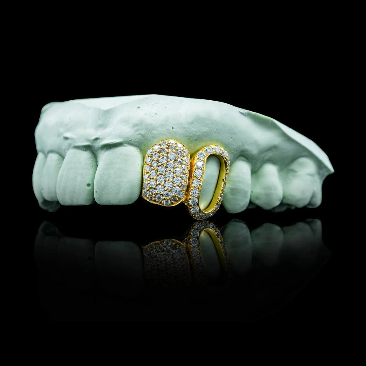 Custom Iced Open Face Double Cap Grillz