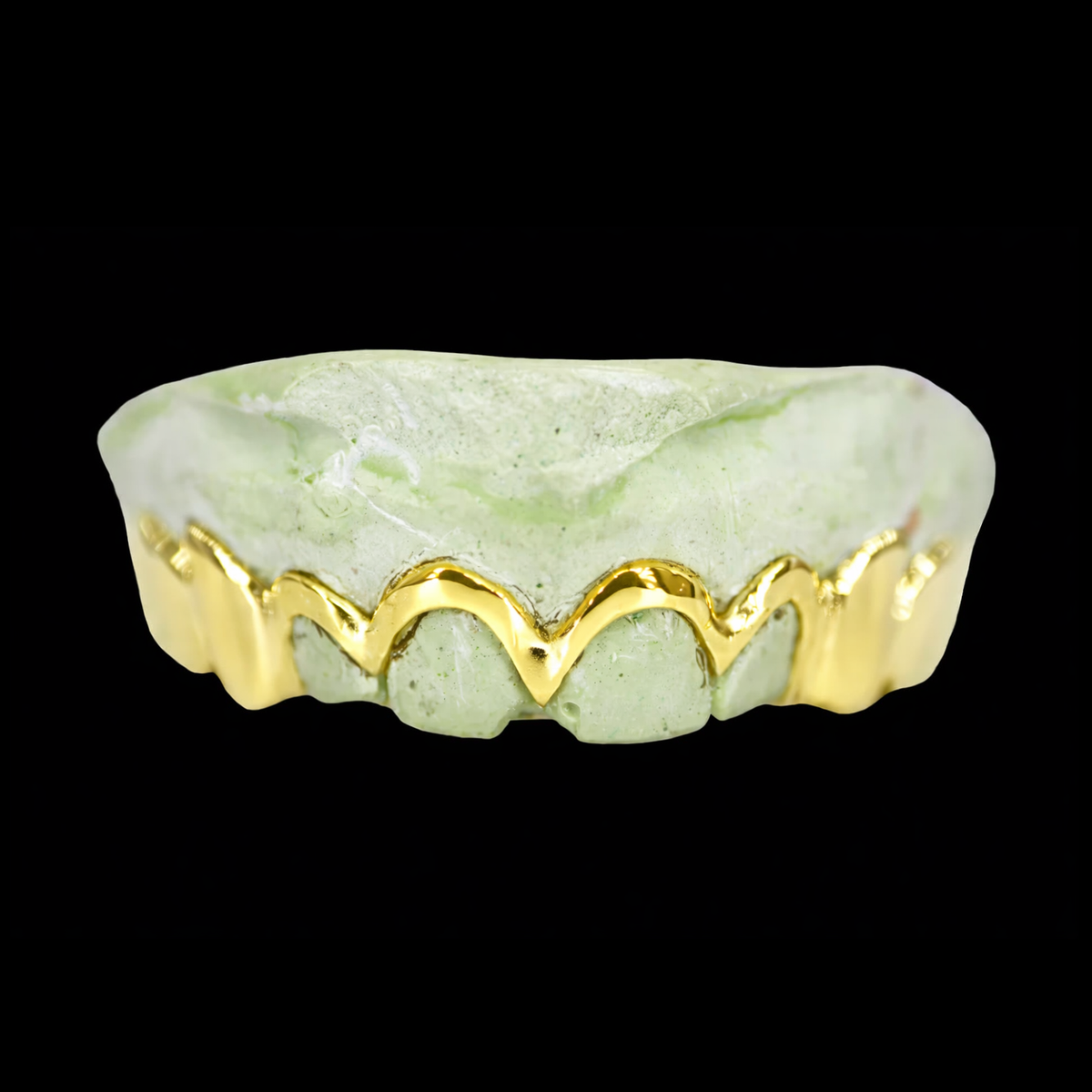 Custom Magneto Gold Grillz