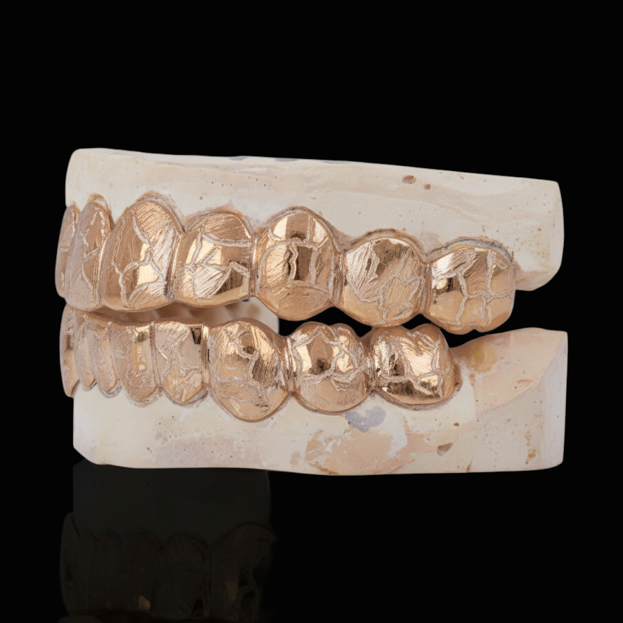 Custom Nugget Style Design Outline Gold Grillz