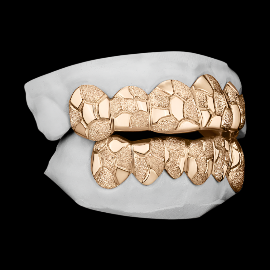 Custom Nugget Style Design Outline Gold Grillz