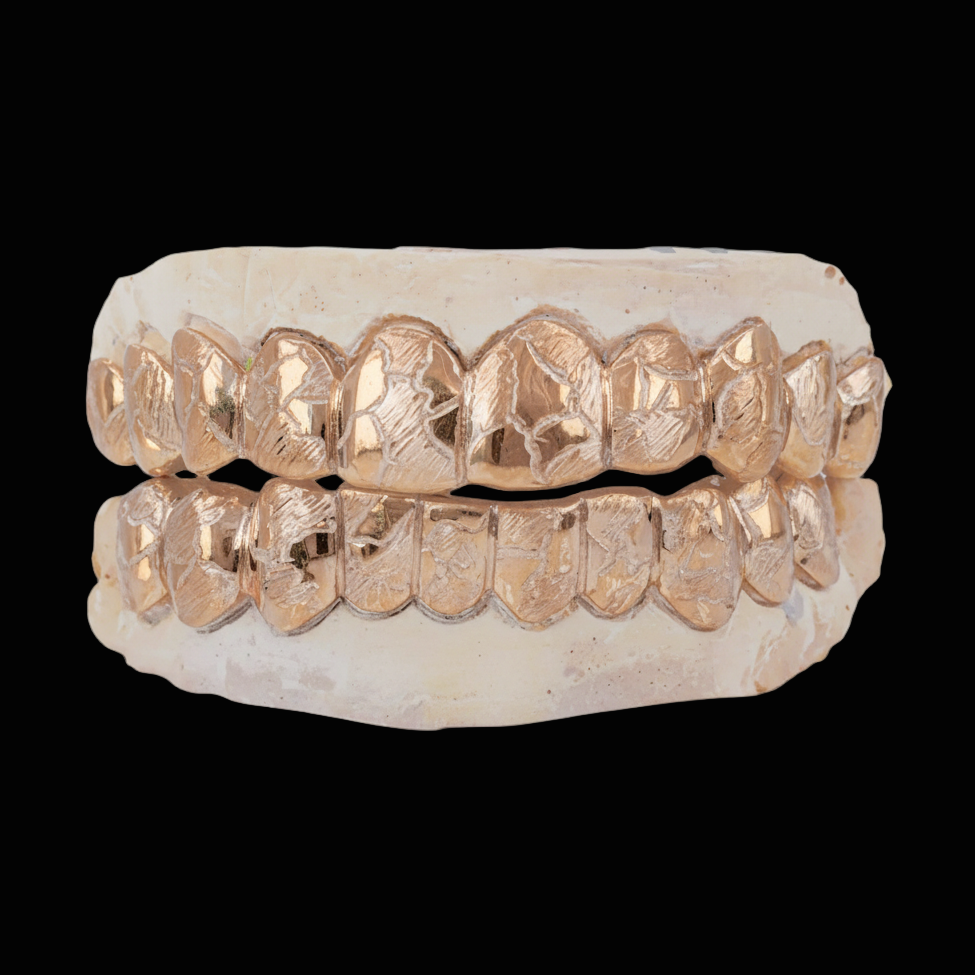 Custom Nugget Style Design Outline Gold Grillz