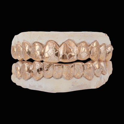 Custom Nugget Style Design Outline Gold Grillz