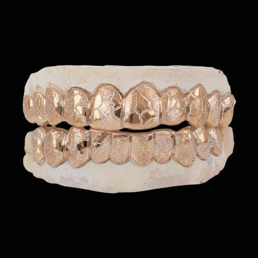 Custom Nugget Style Design Outline Gold Grillz