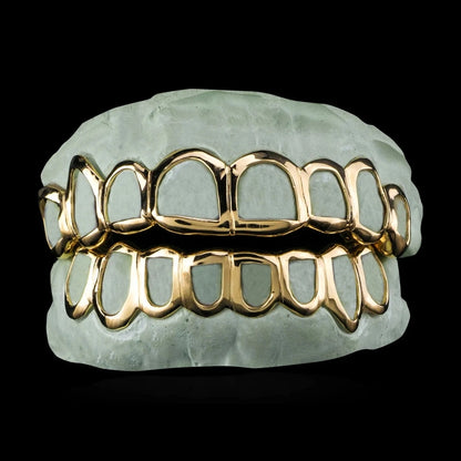 Custom open-face gold grillz set on dental mold showing polished finish
