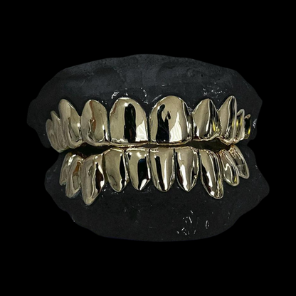 Custom solid gold grillz set on dental mold