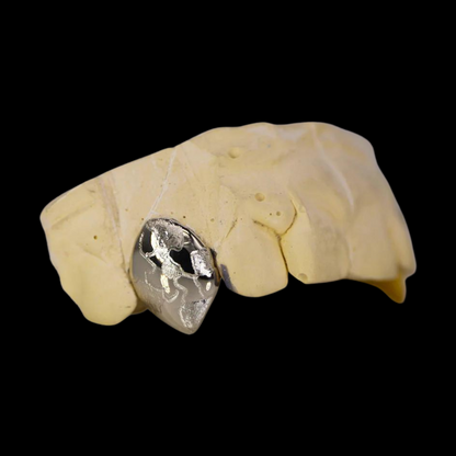 Custom Two-Tone 2 Teeth With Nugget Design Gold Grillz