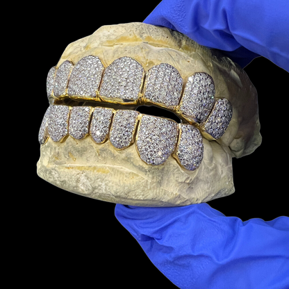 Custom Fit Gold Tone Diamond Grillz Full Pave Upper Lower Teeth Display