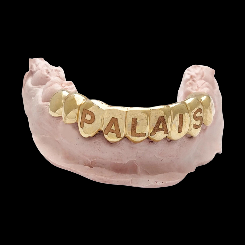 Custom Word/Name Laser Engraving Gold Grillz With Black Rhodium