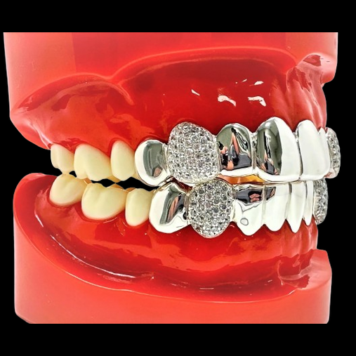 Upper and lower silver fang grillz set showing custom fit on dental model