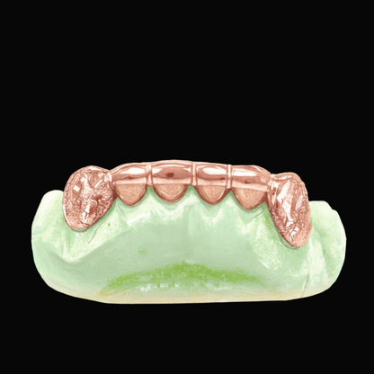 Custom 2 Teeth With Front Bar With Nugget Cut On Fangs Gold Grillz