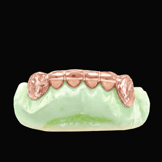 Custom 2 Teeth With Front Bar With Nugget Cut On Fangs Gold Grillz