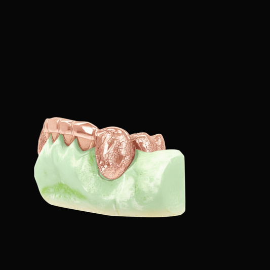 Custom 2 Teeth With Front Bar With Nugget Cut On Fangs Gold Grillz