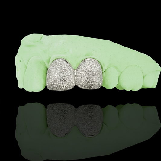 Custom Any 2 Teeth Grillz Diamond Dust (Connected) Gold Grillz