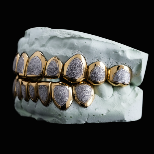Custom Two-Tone Diamond Cut & Diamond Dust W/ Solid Trim Gold Grillz