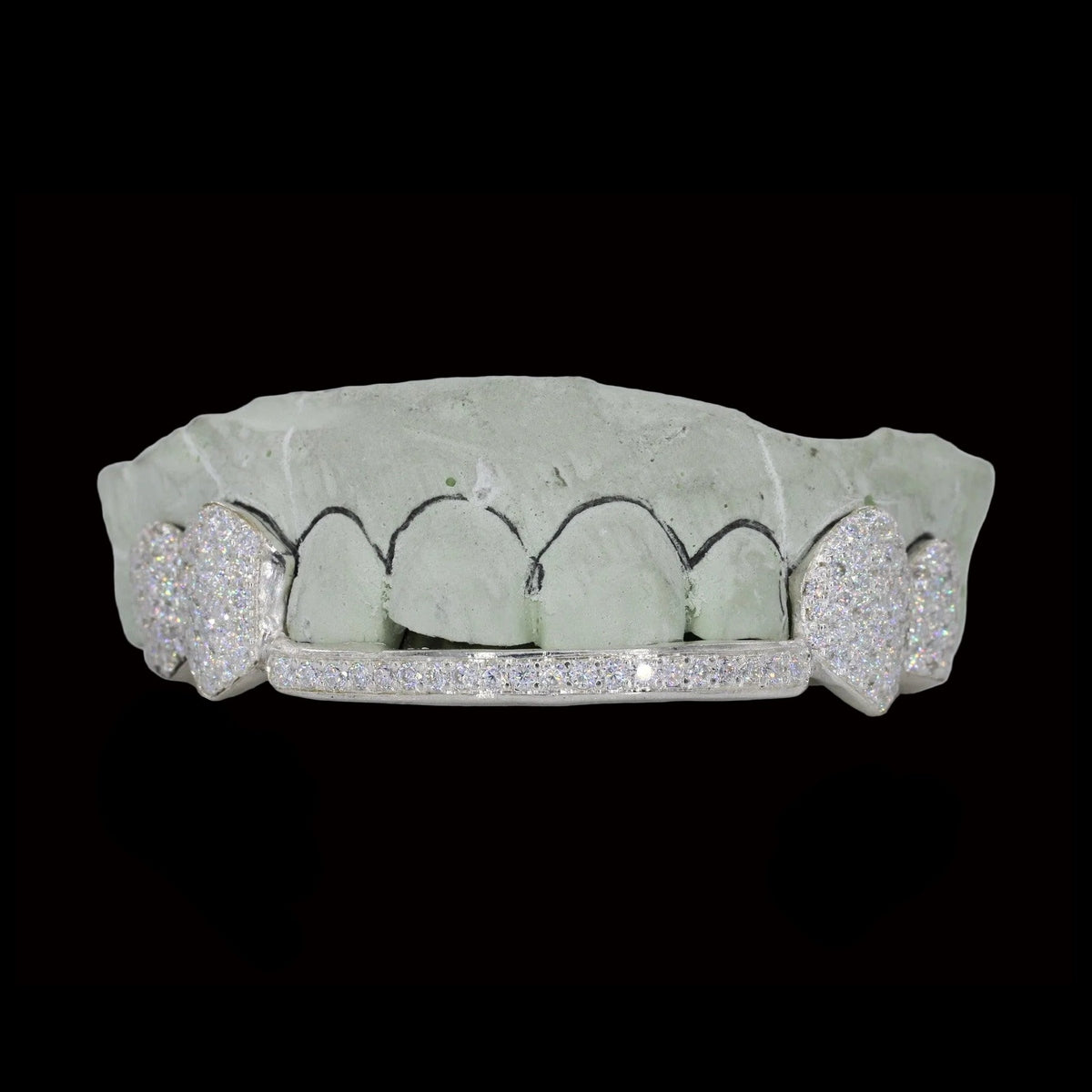 White gold diamond fang grillz with heart cutouts and channel-set lower bar on dental mold