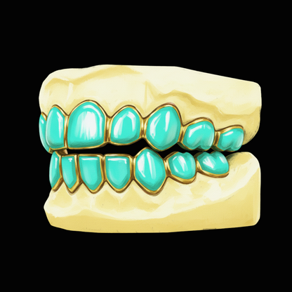 Custom 8 On 8 Mint Condition Gold Grillz