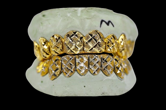 Custom Two-Tone Diamond Cut & Diamond Dust W/ Solid Trim Gold Grillz