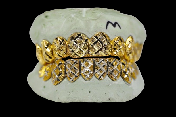 Custom Two-Tone Diamond Cut & Diamond Dust w/ Solid Trim Gold Grillz