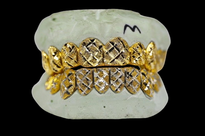 Custom Two-Tone Diamond Cut & Diamond Dust w/ Solid Trim Gold Grillz