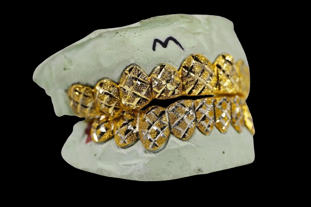 Custom Two-Tone Diamond Cut & Diamond Dust W/ Solid Trim Gold Grillz