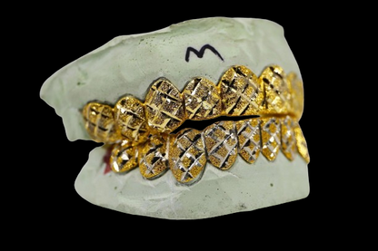 Custom Two-Tone Diamond Cut & Diamond Dust w/ Solid Trim Gold Grillz