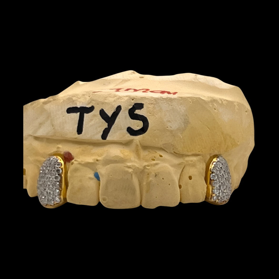 Side View of Custom Gold Tone Iced Out Grillz for Lower Front Teeth