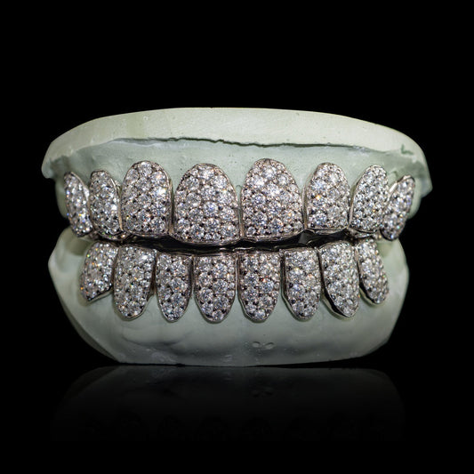 Sterling silver VVS moissanite grillz with large 2mm stones in honeycomb zigzag setting on dental mold