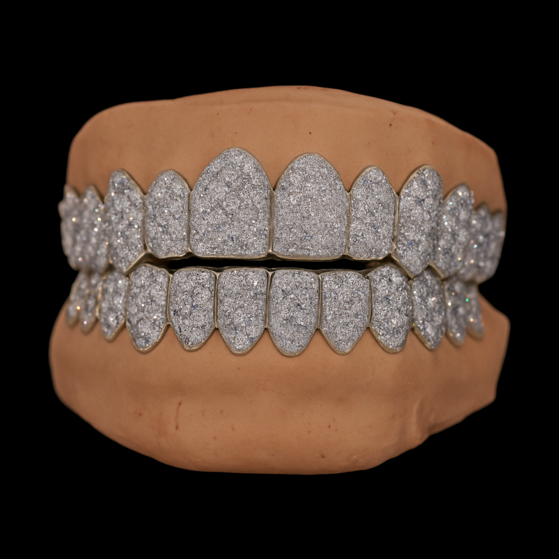 Silver 12-on-12 moissanite grillz set with VVS stones on dental model