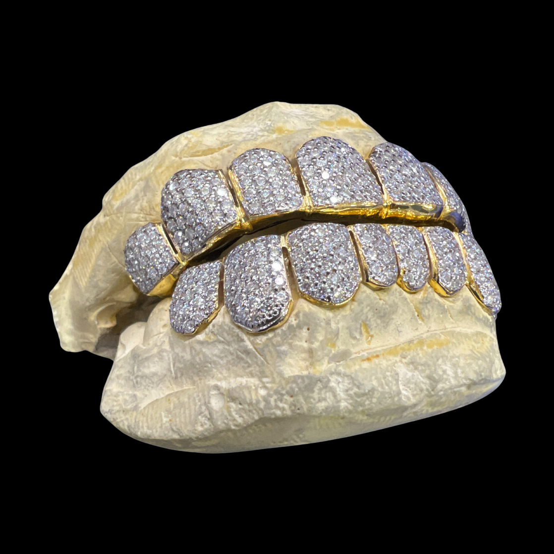 Gold-tone custom 12-on-12 diamond grillz side profile fit