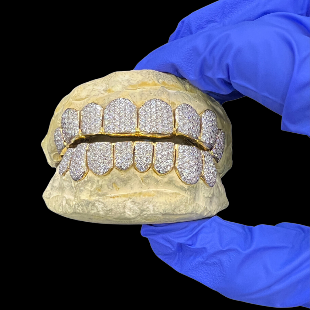 Front view seamless gold 12-on-12 iced-out moissanite grillz