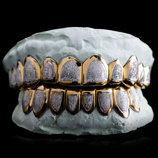 Custom Two-Tone Diamond Cut & Diamond Dust W/ Solid Trim Gold Grillz