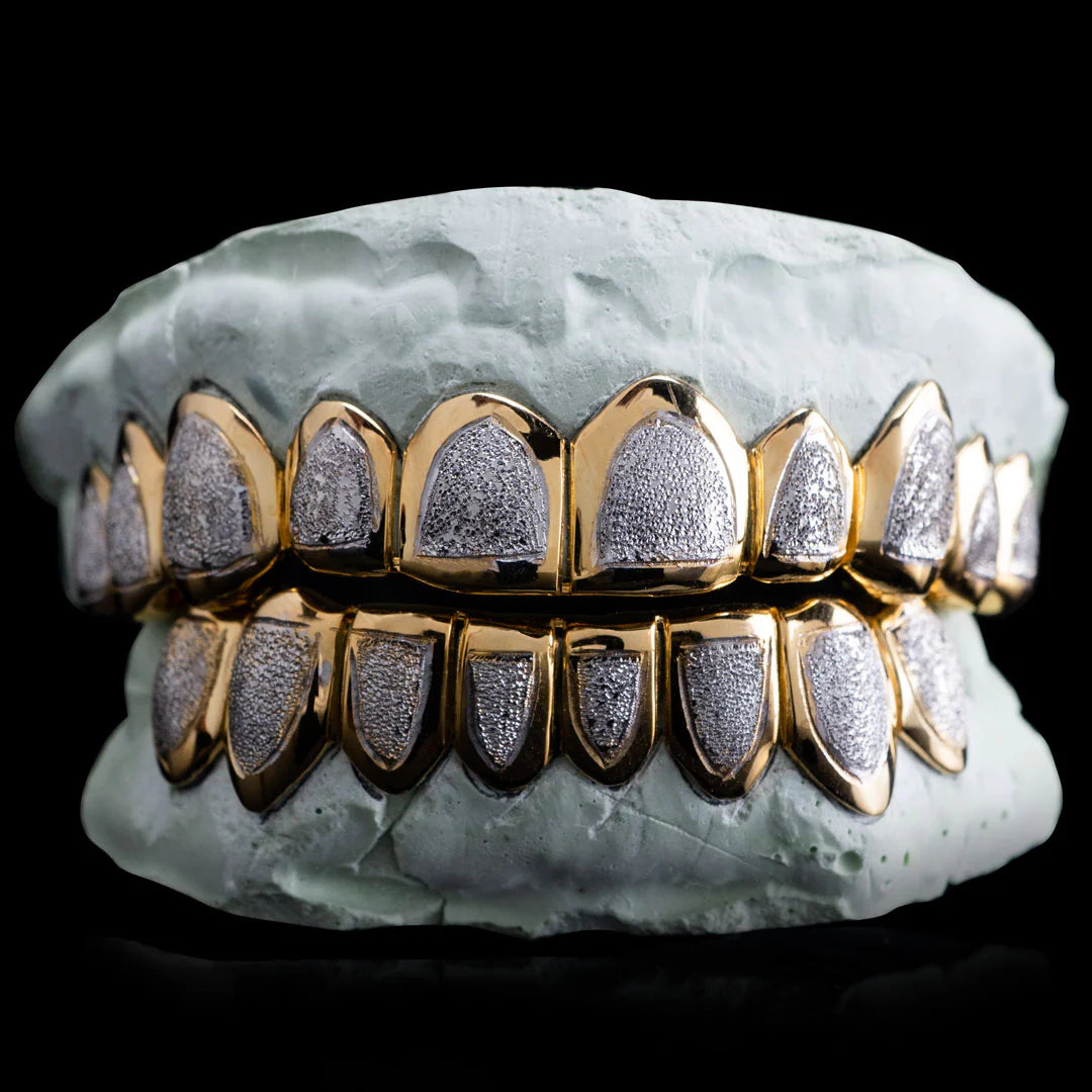 Custom Two-Tone Diamond Cut & Diamond Dust w/ Solid Trim Gold Grillz