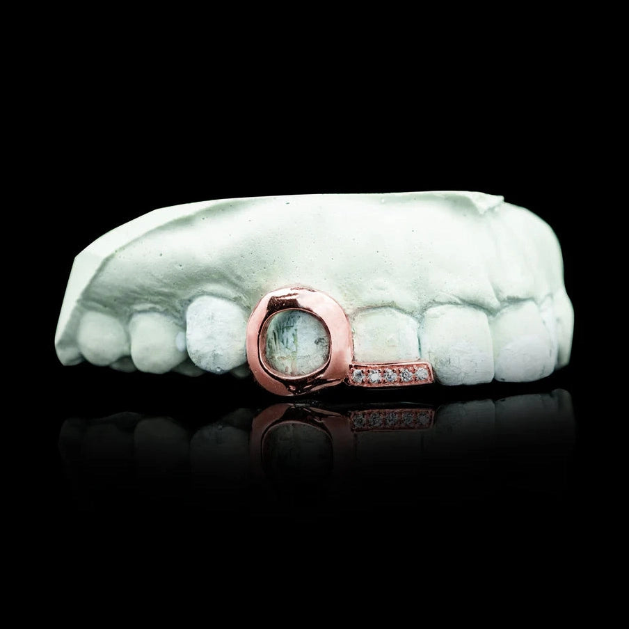 Open Face Heart with Iced Tip Double Cap Gold Grillz