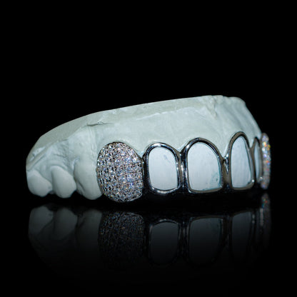 Side view of open face gold grillz on dental mold with diamond teeth