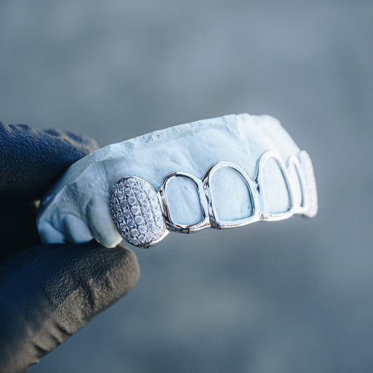 Close-up of custom open face grillz featuring dense pave stone setting