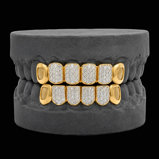 Open Face Grillz