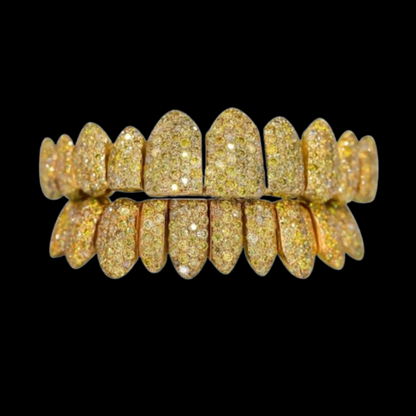 VVS Yellow Canary Moissanite Diamond Grillz