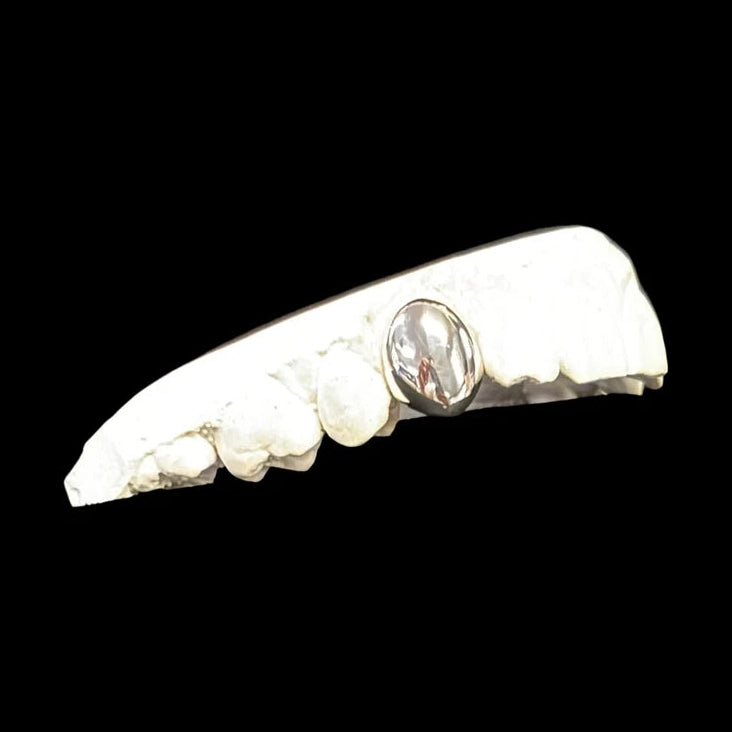 Single tooth sterling silver grillz on dental model