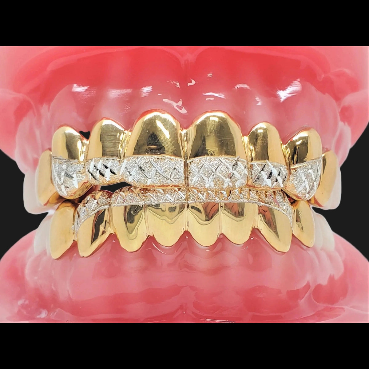 Gold diamond-cut custom fit grillz set on dental model
