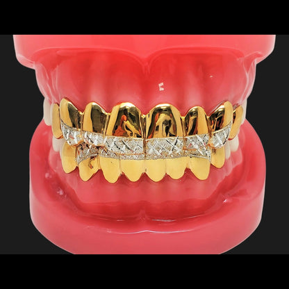Full gold diamond-cut custom fit grillz set for teeth